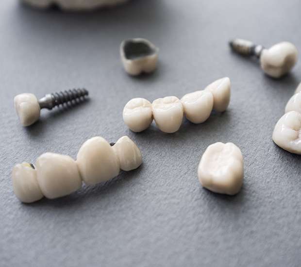 Peoria The Difference Between Dental Implants and Mini Dental Implants