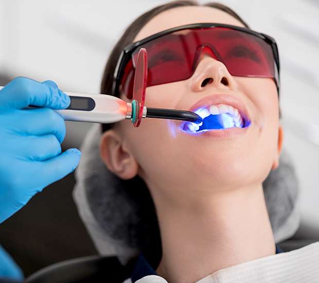 Peoria Professional Teeth Whitening