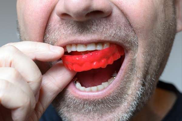Save Your Teeth by Wearing Mouth Guards at Night from Vogue Dental in Peoria, IL
